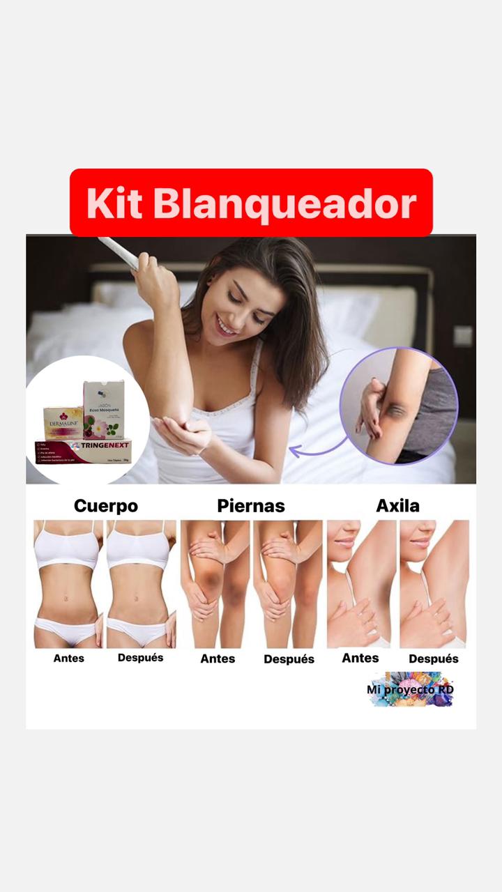 Kit Blanqueador